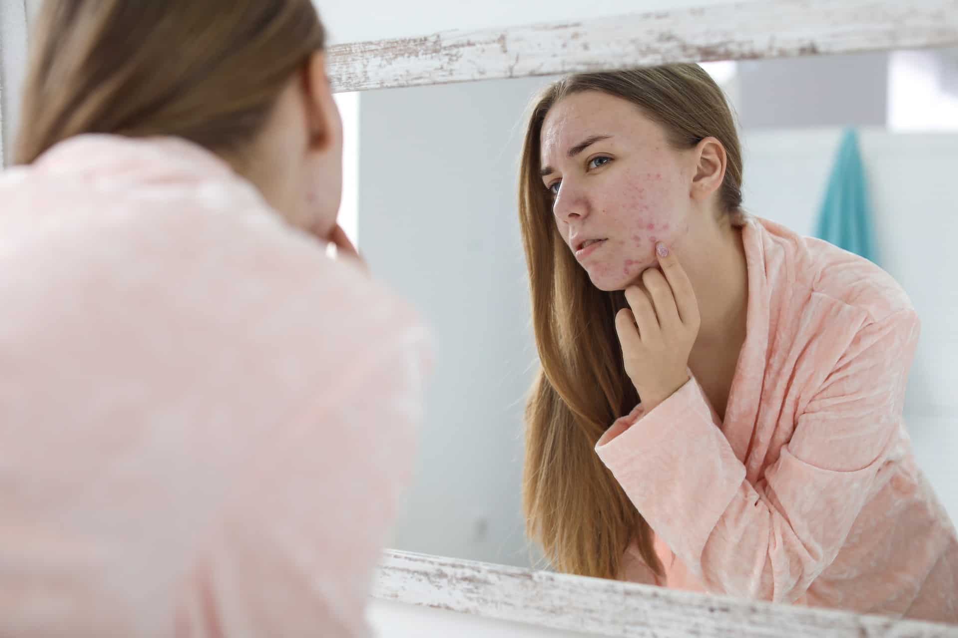 traiter problemes acne